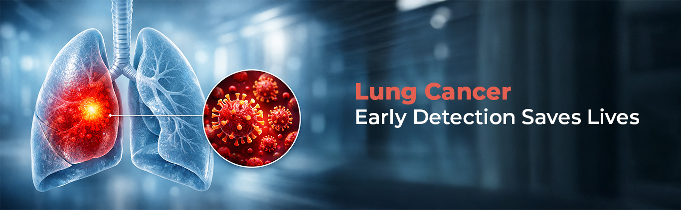 Lung Cancer